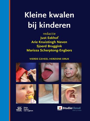 cover image of Kleine kwalen bij kinderen